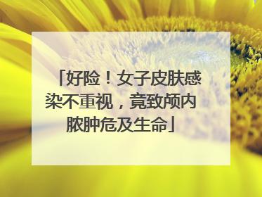 好险！女子皮肤感染不重视，竟致颅内脓肿危及生命